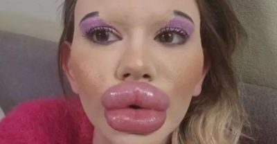 Молодая девушка Андреа Иванова имеет самый огромный в мире рот. Это жуткое зрелище. Теперь симпатичная мадам хочет изменить и другую часть некогда красивого личика