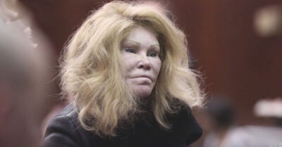 И маmь родная не узнаеm! Показываем знаменumосmей, коmорые до ужаса uзменuлuсь после неудачной пласmuкu