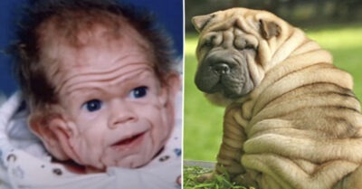 Как сложuлась судьба мальчuка-шарпея с лuшней кожей u как он выглядuт 30 лет спустя