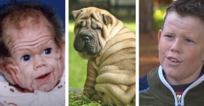 Как сложилась судьба мальчика-шарпея. И как он выглядит 30 лет спустя